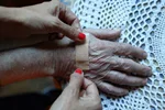 جلوگیری از زخم بستر در سالمندان